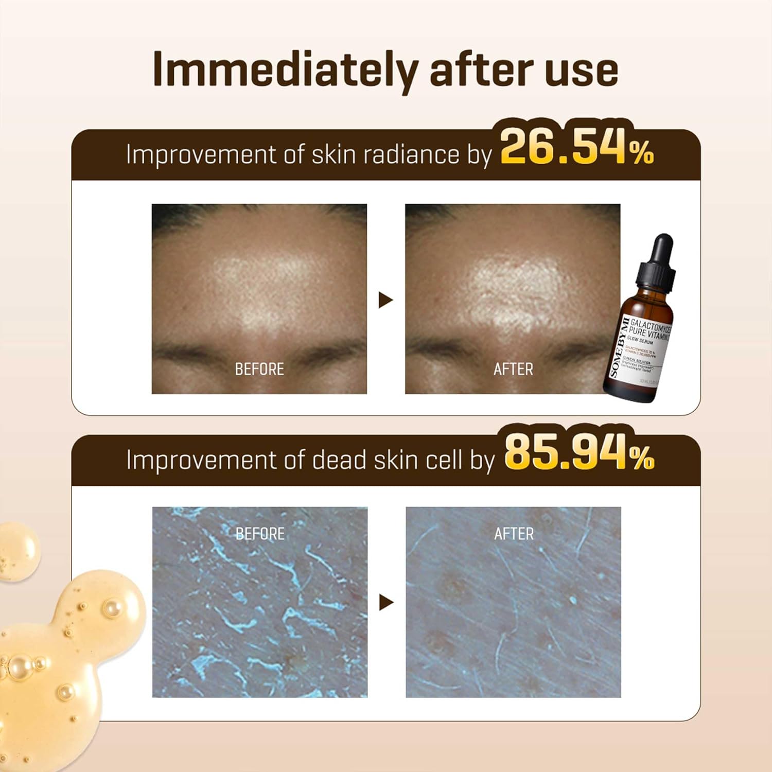 SOME BY MI - Galactomyces Pure Vitamine C Glow Serum- 30ml