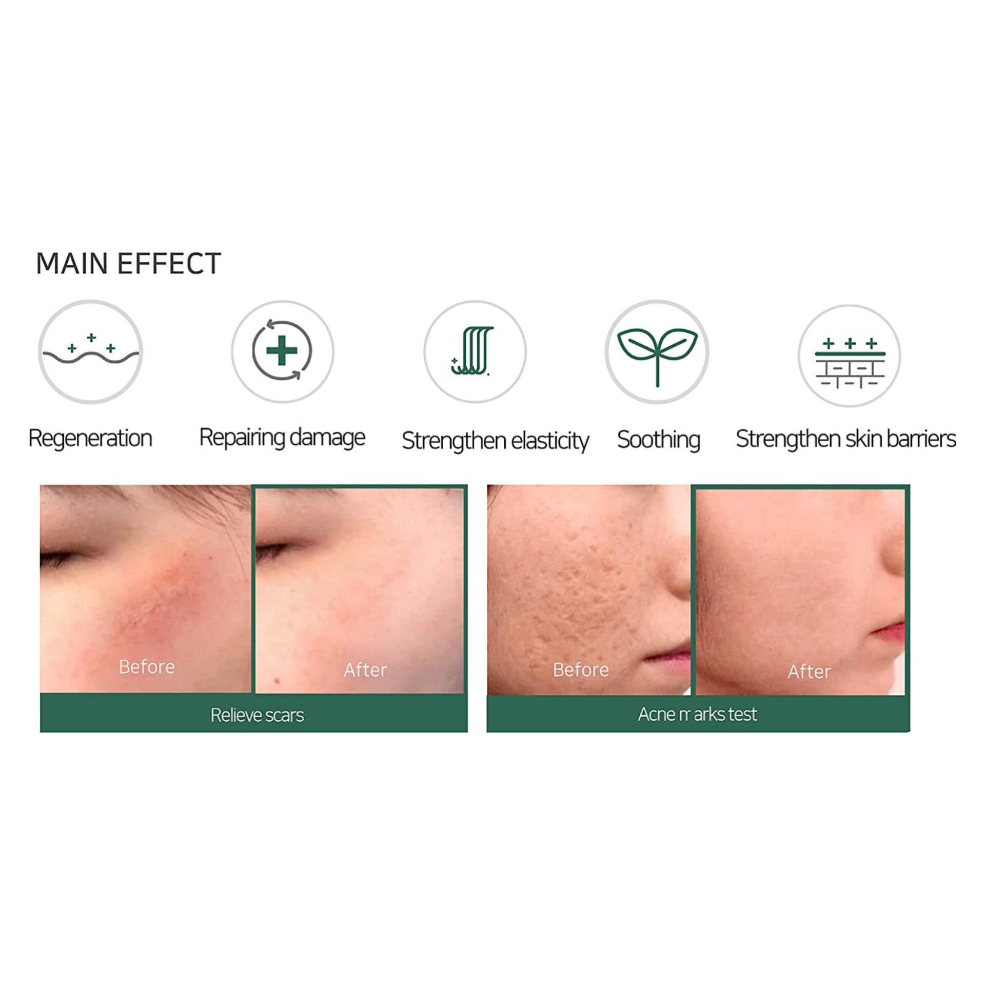 some-by-mi-aha-bha-pha-30-days-miracle-cream-60g