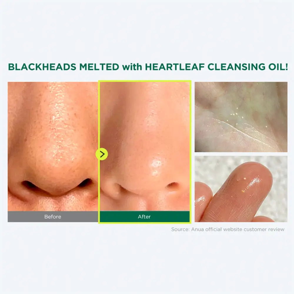 ANUA Heartleaf Pore Control Cleansing Oil 200ml masques