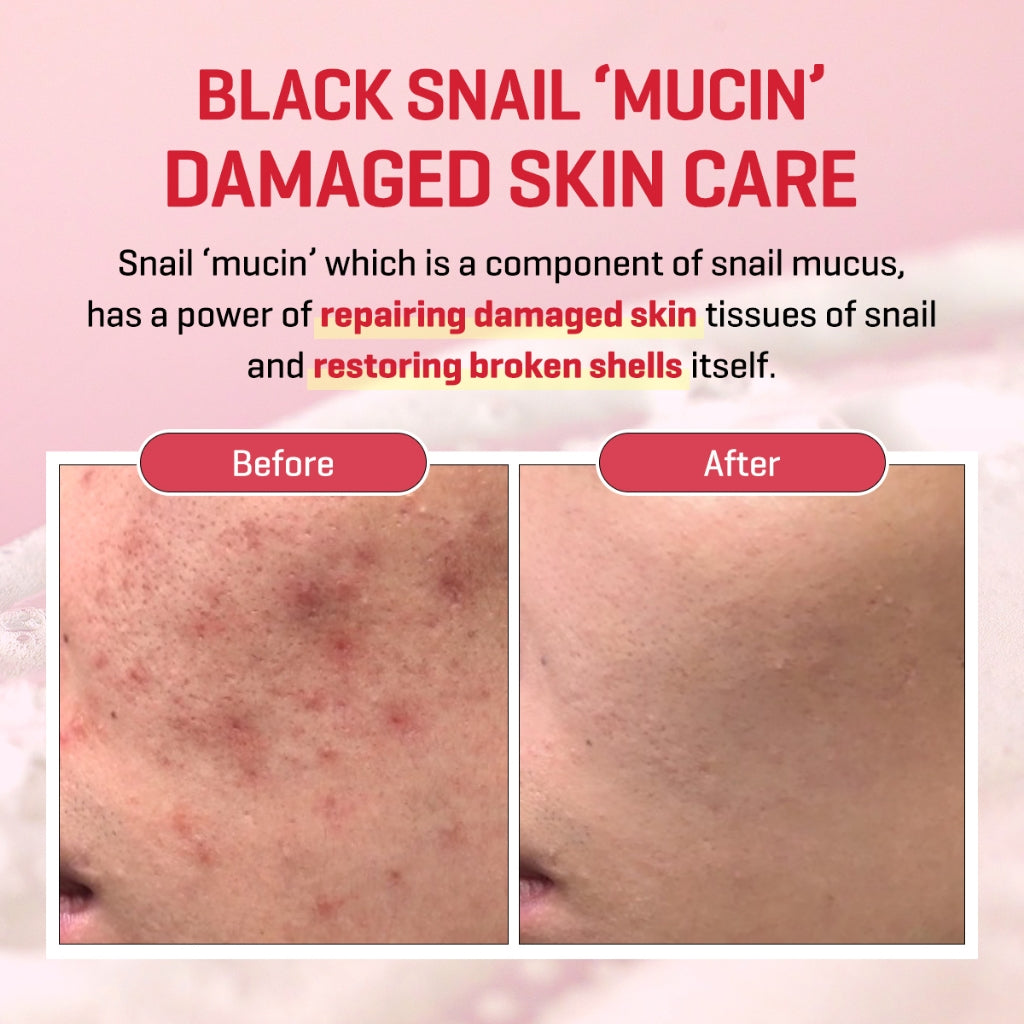 SOME BY MI - SNAIL TRUECICA MIRACLE CREAM - 50ml